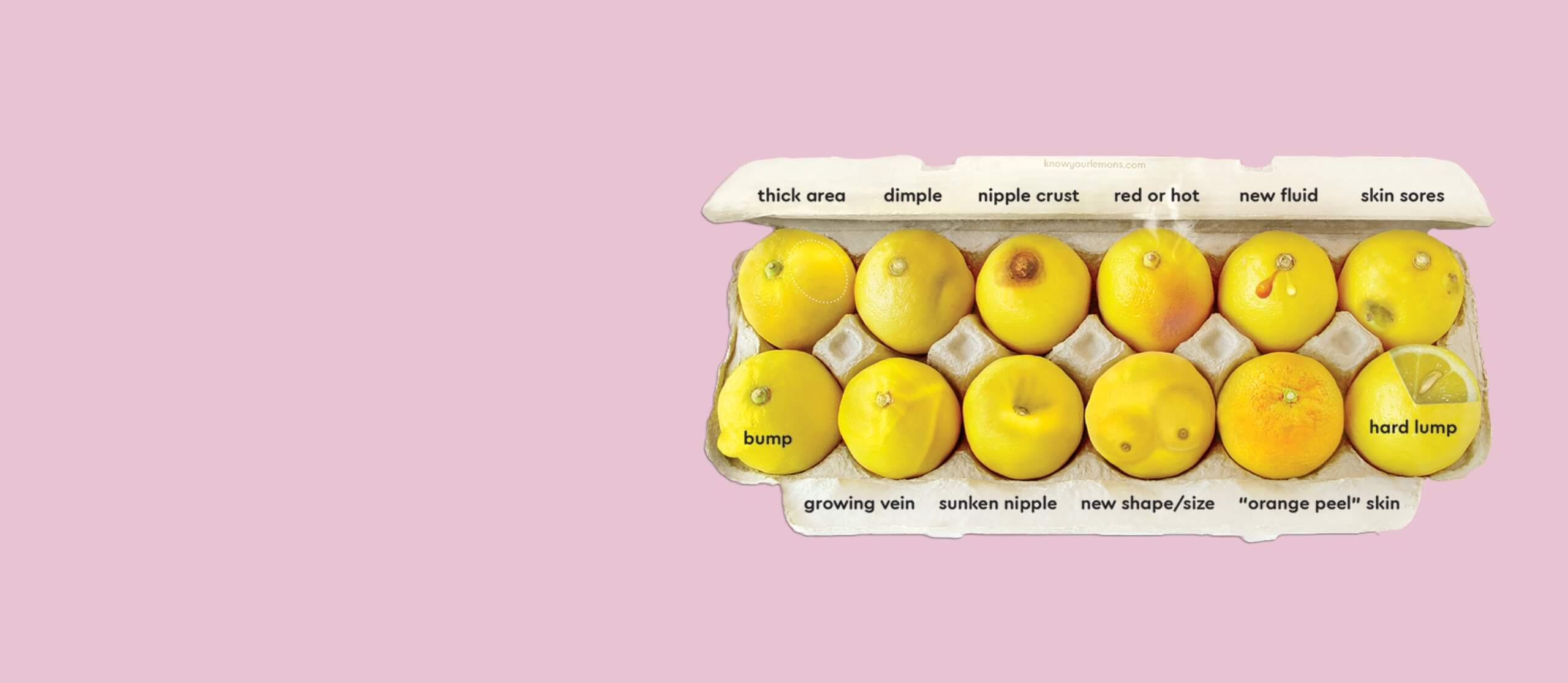 Know Your Lemons x NA-KD | NA-KD
